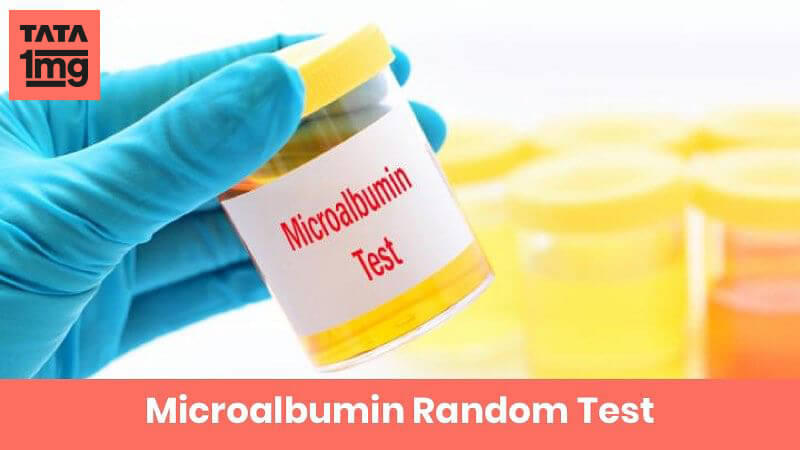 Microalbumin Random